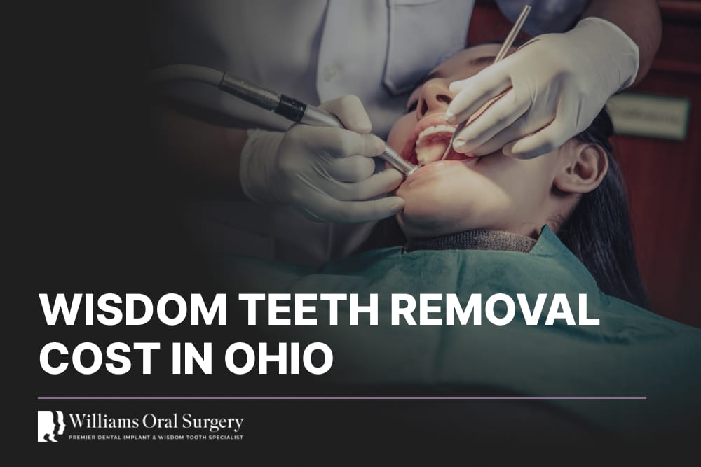 wisdom teeth removal cost in ohio