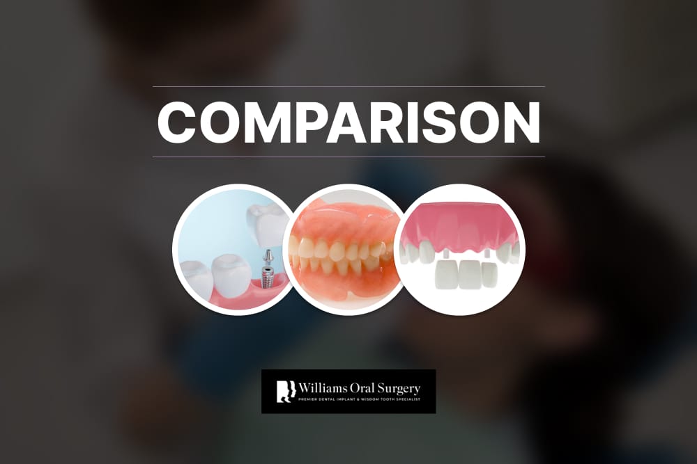 dental replacement comparison